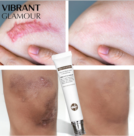 Vibrant Glamour cream or gel for skin repair